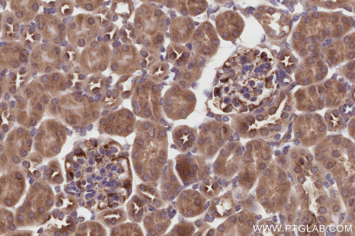 IHC staining of mouse kidney using 27146-1-AP Immunohistochemistry (IHC) staining of mouse kidney tissue using NEK1 Polyclonal antibody (27146-1-AP)
