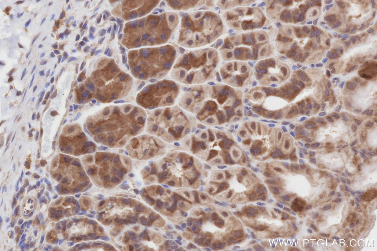 IHC staining of mouse stomach using 27146-1-AP Immunohistochemistry (IHC) staining of mouse stomach tissue using NEK1 Polyclonal antibody (27146-1-AP)