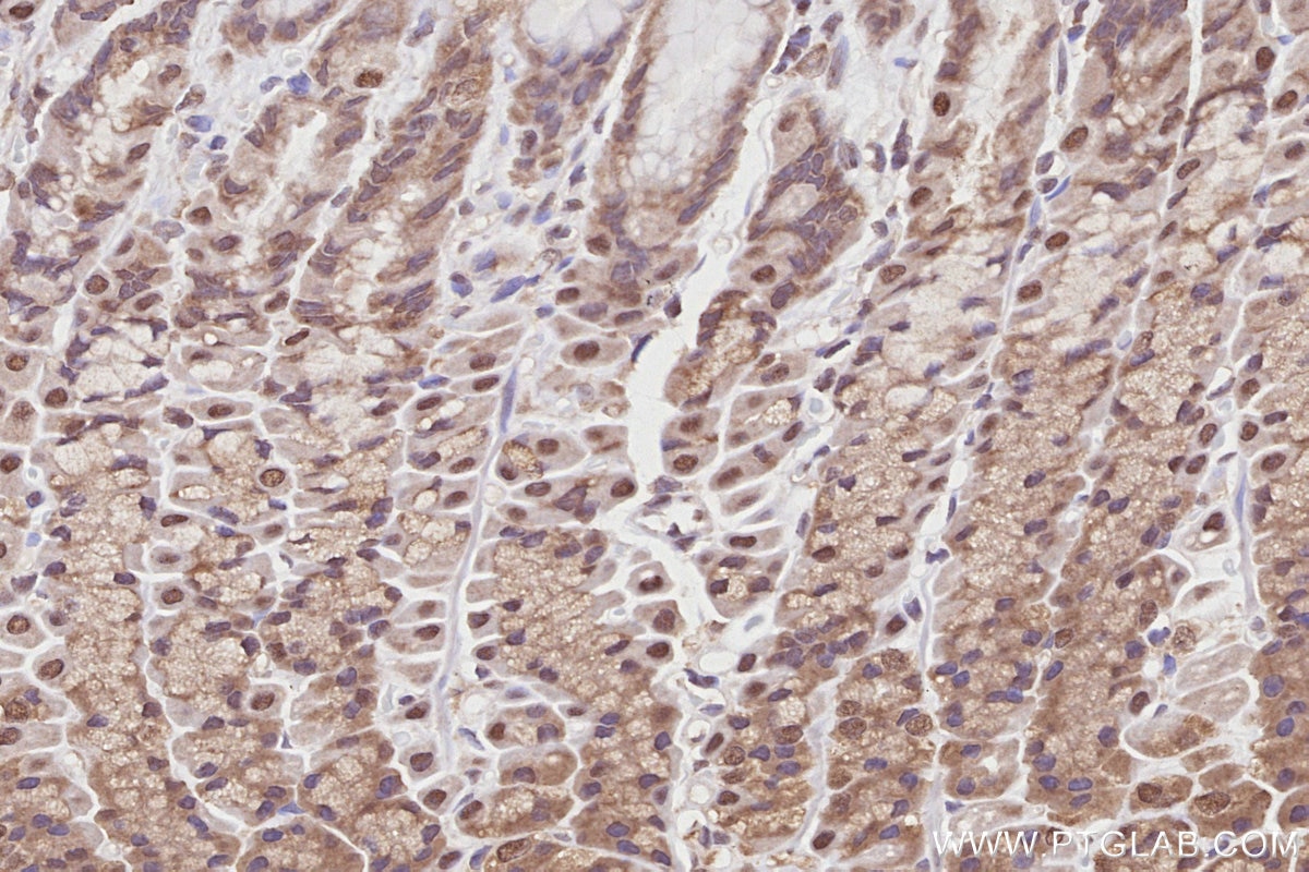 IHC staining of rat stomach using 27146-1-AP Immunohistochemistry (IHC) staining of rat stomach tissue using NEK1 Polyclonal antibody (27146-1-AP)