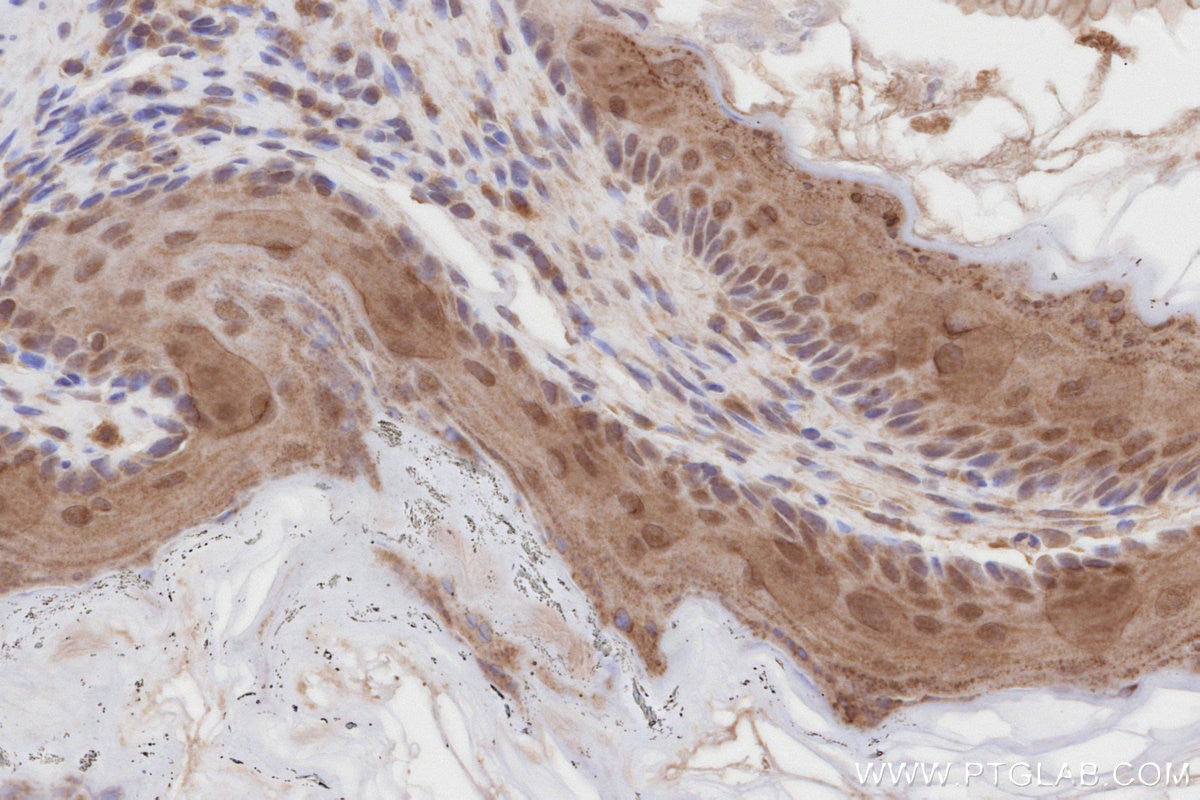 IHC staining of mouse stomach using 27146-1-AP Immunohistochemistry (IHC) staining of mouse stomach tissue using NEK1 Polyclonal antibody (27146-1-AP)
