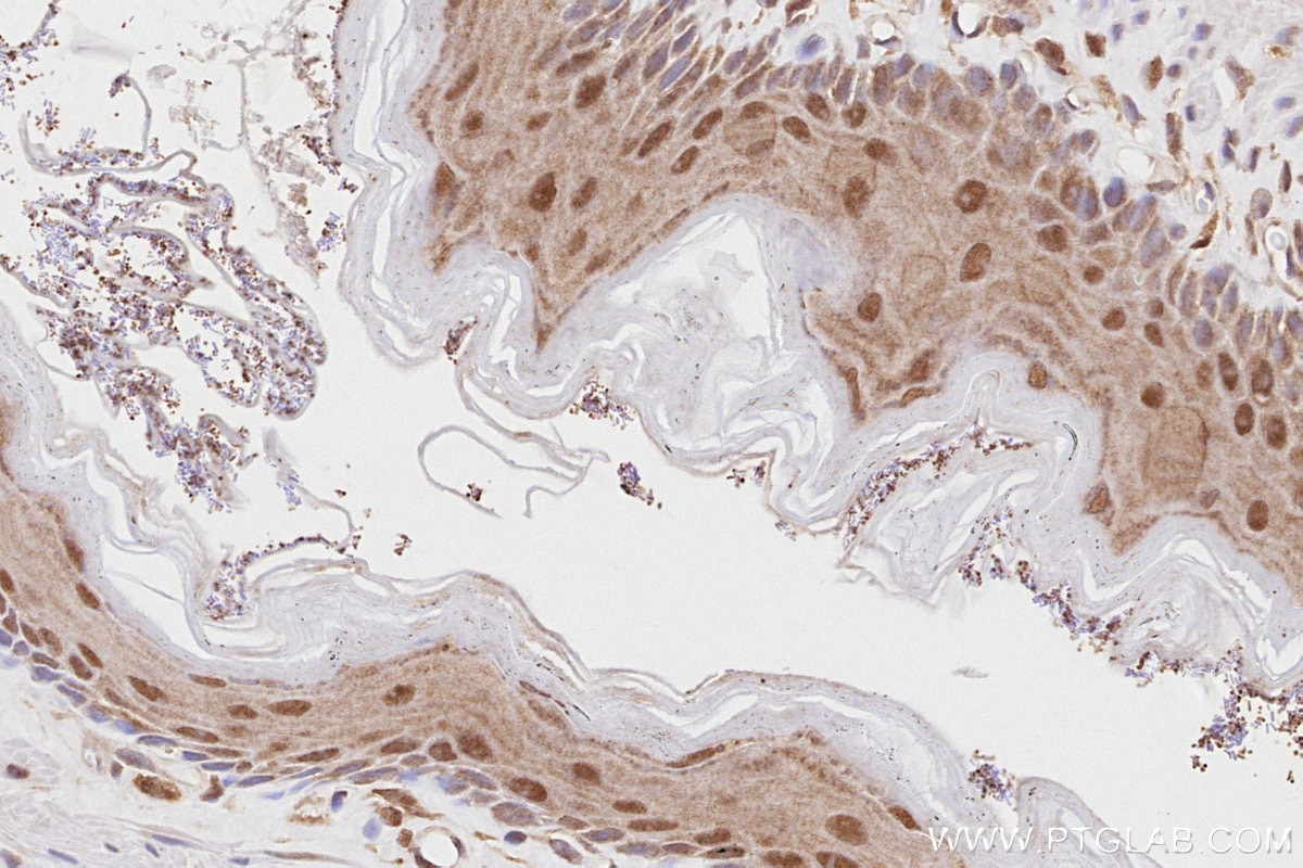 IHC staining of rat stomach using 27146-1-AP Immunohistochemistry (IHC) staining of rat stomach tissue using NEK1 Polyclonal antibody (27146-1-AP)
