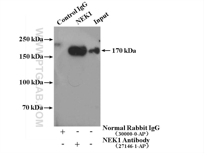 Immunoprecipitation (IP) experiment of PC-12 cells using NEK1 Polyclonal antibody (27146-1-AP)
