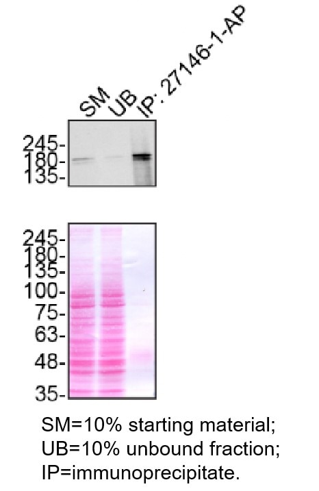 Immunoprecipitation (IP) experiment of HeLa cells using NEK1 Polyclonal antibody (27146-1-AP)