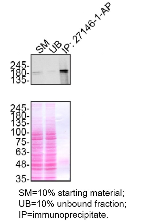 IP experiment of HeLa using 27146-1-AP