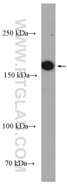 Western Blot (WB) analysis of PC-12 cells using NEK1 Polyclonal antibody (27146-1-AP)
