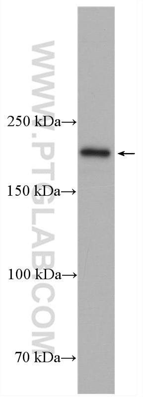 Western Blot (WB) analysis of mouse pancreas tissue using NEK1 Polyclonal antibody (27146-1-AP)