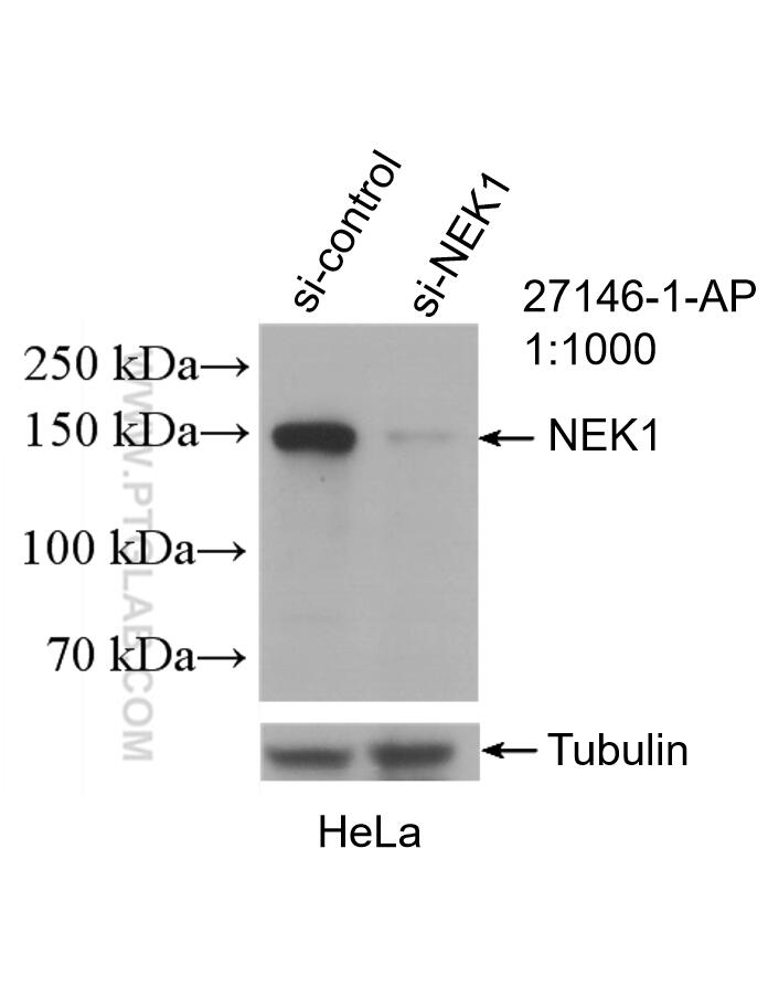 Western Blot (WB) analysis of HeLa cells using NEK1 Polyclonal antibody (27146-1-AP)