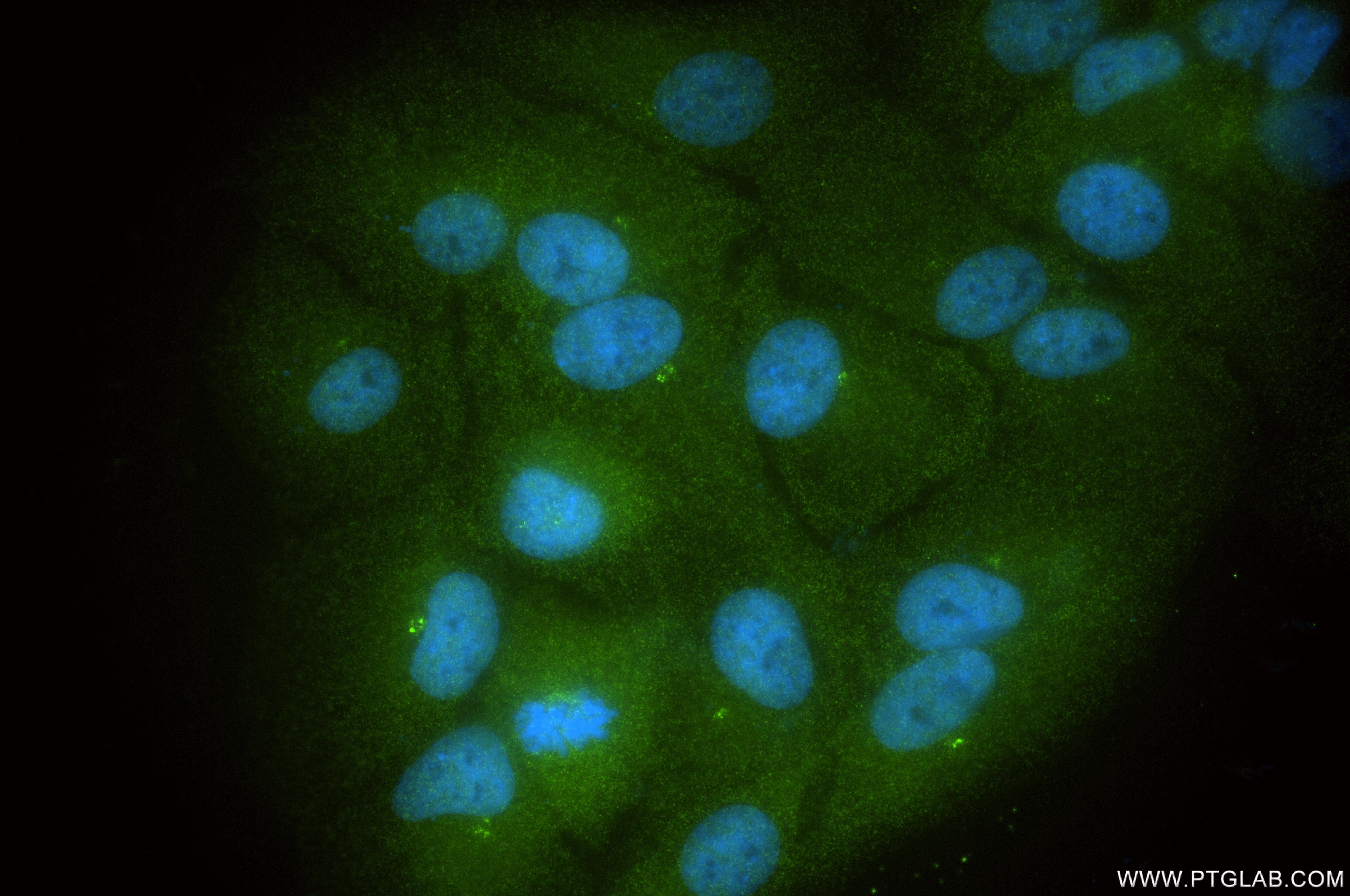 IF Staining of hTERT-RPE1 using 86224-2-RR (same clone as 86224-2-PBS) Immunofluorescence (IF) / fluorescent staining of hTERT-RPE1 cells using NEK1 Recombinant monoclonal antibody (86224-2-RR)
