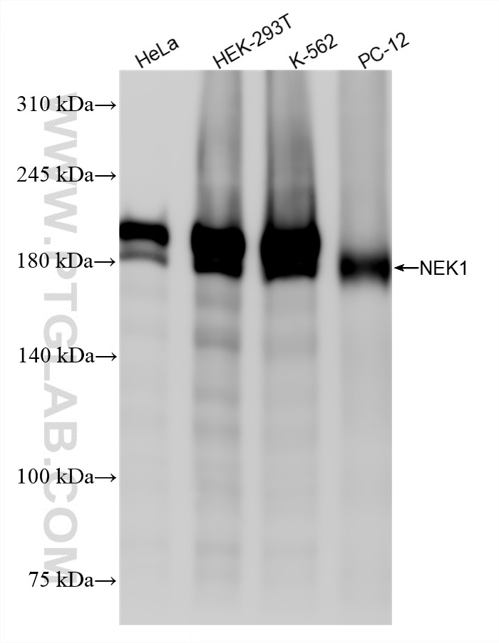 WB analysis using 86224-2-RR (same clone as 86224-2-PBS) Western Blot (WB) analysis of various lysates using NEK1 Recombinant monoclonal antibody (86224-2-RR)