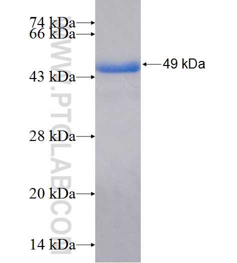 NEK1 fusion protein Ag25970 SDS-PAGE