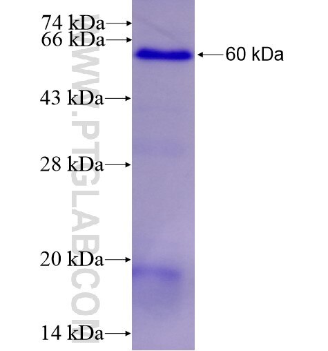 NEK10 fusion protein Ag11640 SDS-PAGE