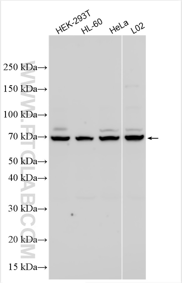 Western Blot (WB) analysis of various lysates using NEK11 Polyclonal antibody (12710-1-AP)