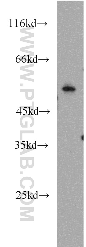 Western Blot (WB) analysis of HeLa cells using NEK11 Polyclonal antibody (12710-1-AP)