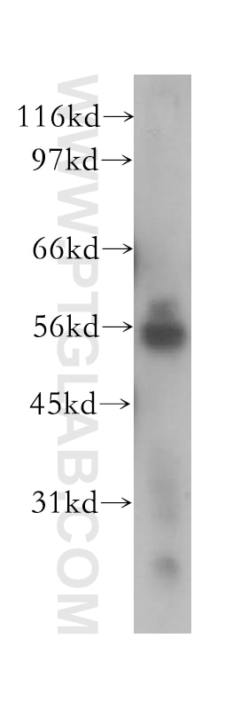 Western Blot (WB) analysis of HeLa cells using NEK11 Polyclonal antibody (12710-1-AP)