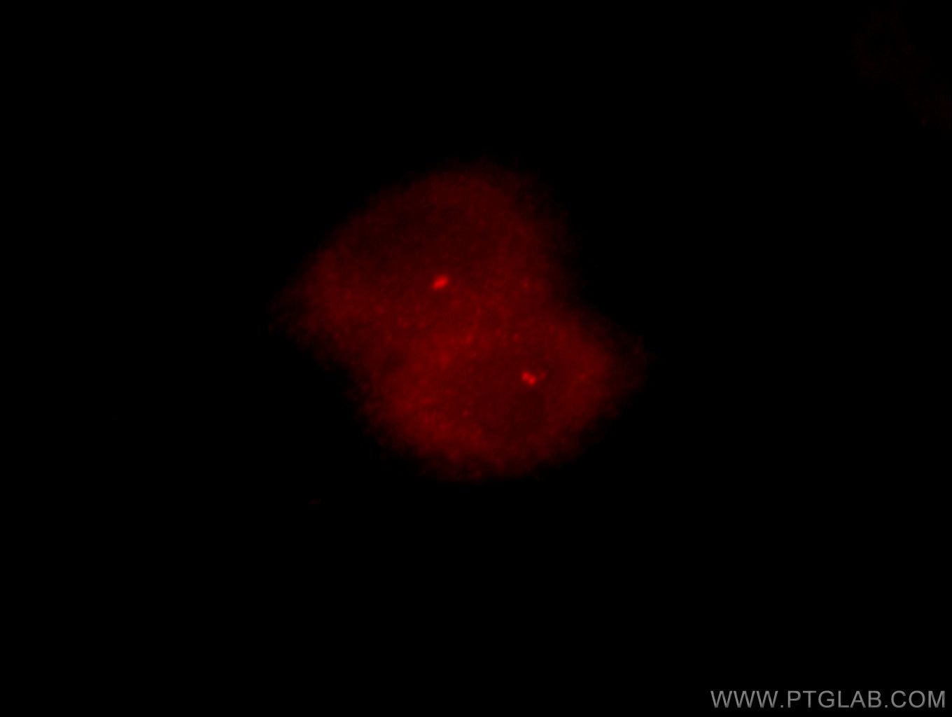 Immunofluorescence (IF) / fluorescent staining of HeLa cells using NEK2 Polyclonal antibody (14233-1-AP)