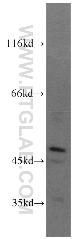 Western Blot (WB) analysis of K-562 cells using NEK2 Polyclonal antibody (14233-1-AP)