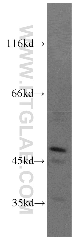 NEK2 Polyclonal antibody