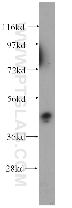 Western Blot (WB) analysis of K-562 cells using NEK2 Polyclonal antibody (14233-1-AP)