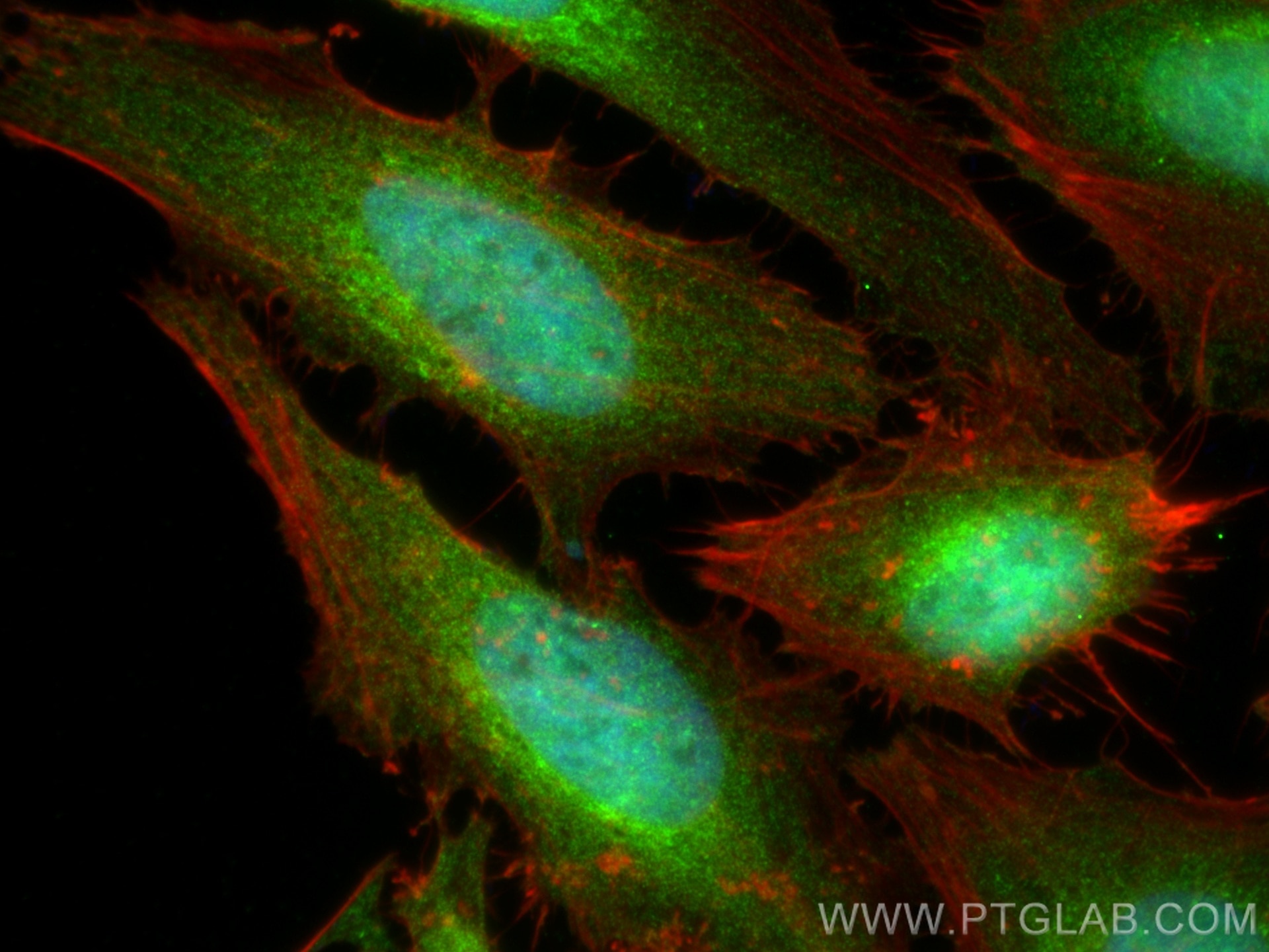 Immunofluorescence (IF) / fluorescent staining of HeLa cells using NEK2 Polyclonal antibody (24171-1-AP)