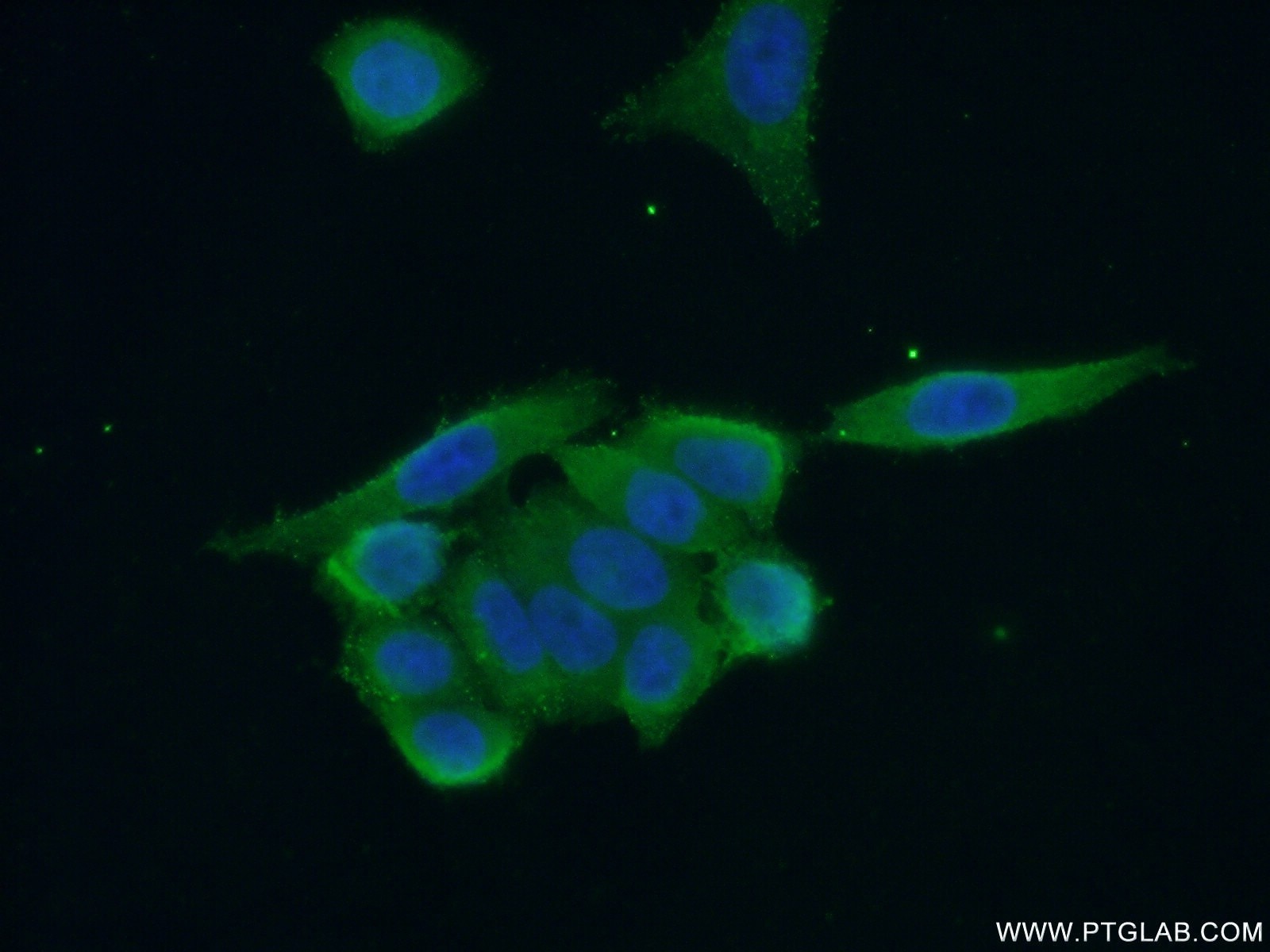 Immunofluorescence (IF) / fluorescent staining of HeLa cells using NEK2 Polyclonal antibody (24171-1-AP)