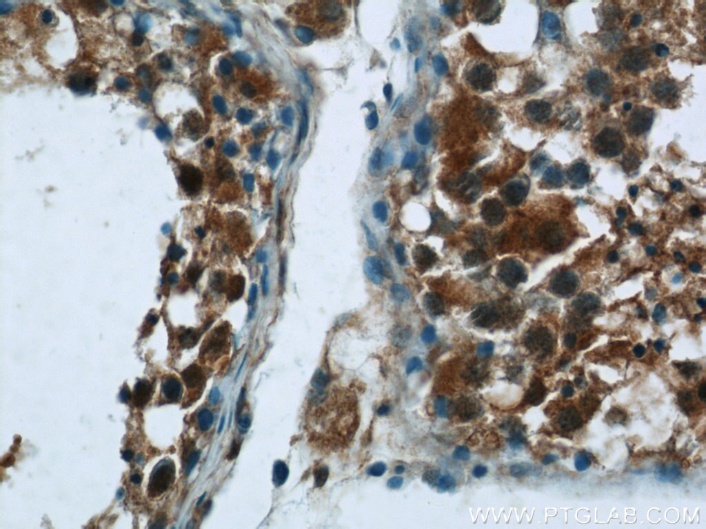 NEK2 Polyclonal antibody