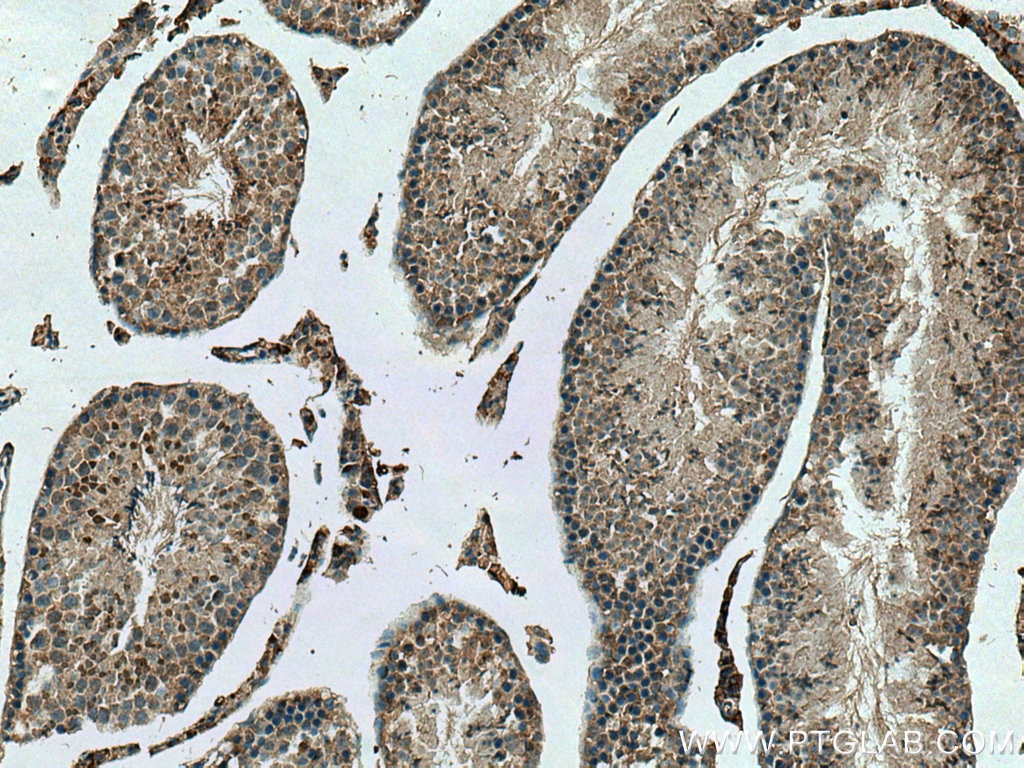 IHC staining of mouse testis using 24171-1-AP