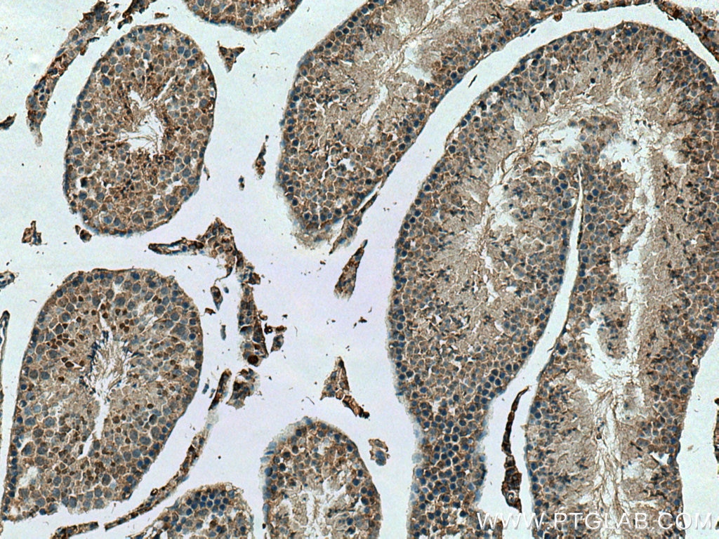 Immunohistochemistry (IHC) staining of mouse testis tissue using NEK2 Polyclonal antibody (24171-1-AP)