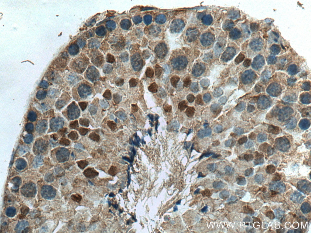 Immunohistochemistry (IHC) staining of mouse testis tissue using NEK2 Polyclonal antibody (24171-1-AP)