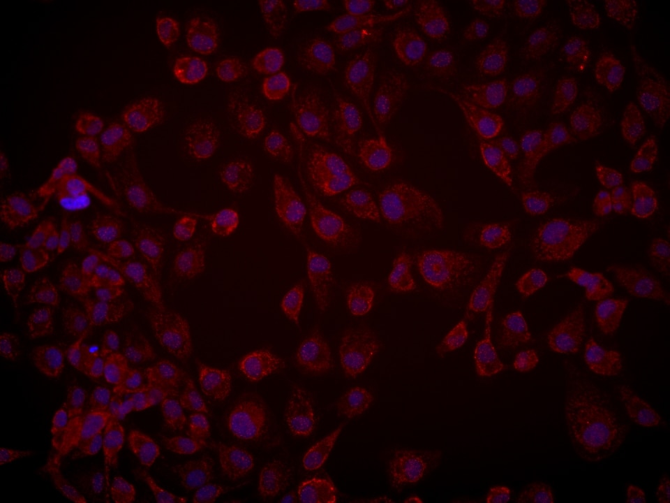 Immunofluorescence (IF) / fluorescent staining of A431 cells using NEK2 Monoclonal antibody (66632-1-Ig)