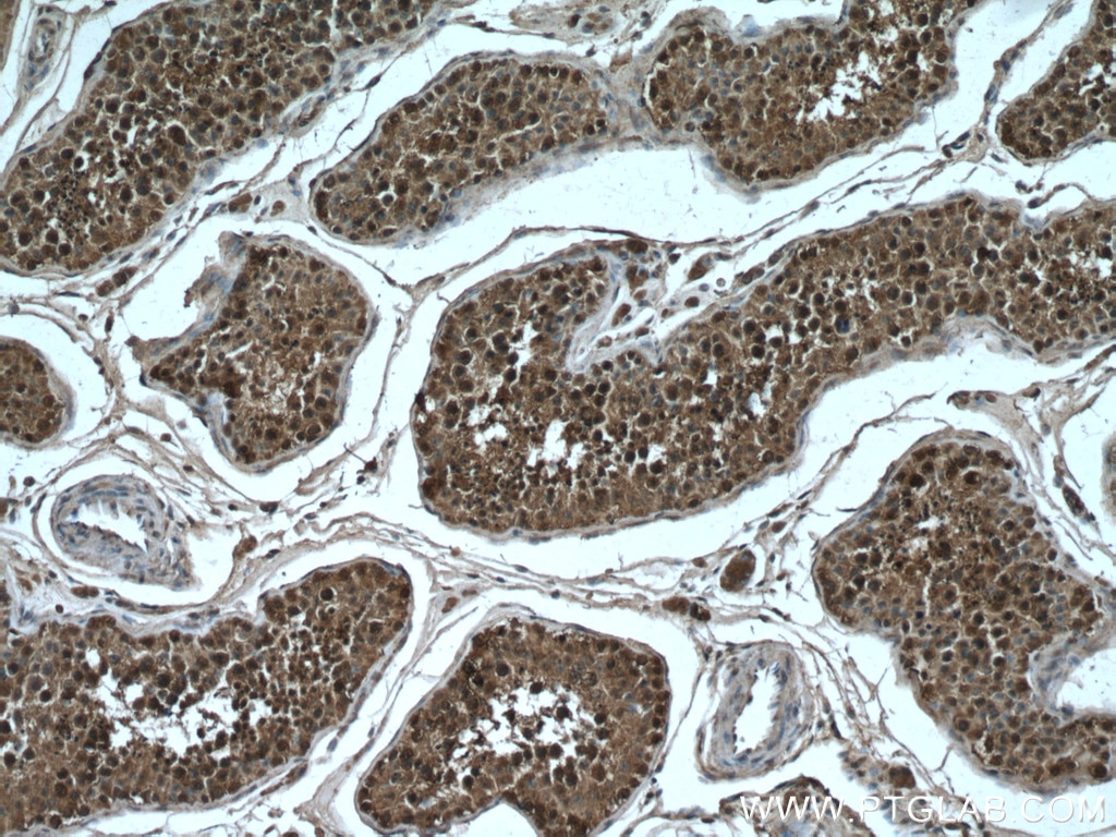 Immunohistochemistry (IHC) staining of human testis tissue using NEK2 Monoclonal antibody (66632-1-Ig)