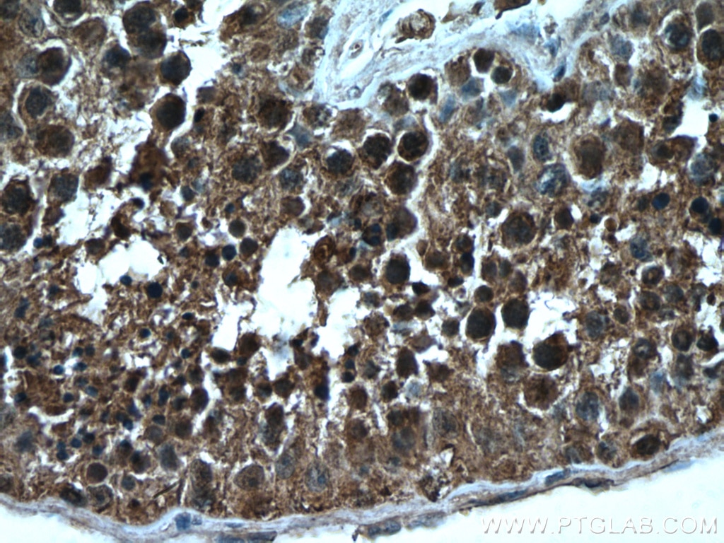 Immunohistochemistry (IHC) staining of human testis tissue using NEK2 Monoclonal antibody (66632-1-Ig)