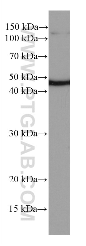 Western Blot (WB) analysis of Jurkat cells using NEK2 Monoclonal antibody (66632-1-Ig)