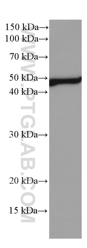 Western Blot (WB) analysis of human peripheral blood leukocyte using NEK2 Monoclonal antibody (66632-1-Ig)