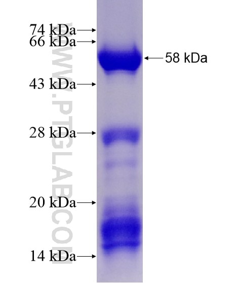 NEK2 fusion protein Ag21476 SDS-PAGE