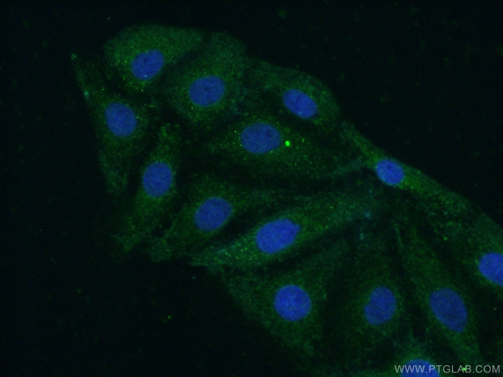 Immunofluorescence (IF) / fluorescent staining of SH-SY5Y cells using NEK3 Polyclonal antibody (12843-1-AP)