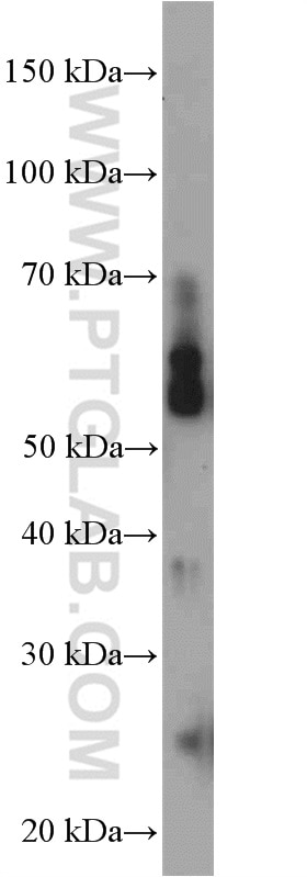 Western Blot (WB) analysis of SH-SY5Y cells using NEK3 Polyclonal antibody (12843-1-AP)