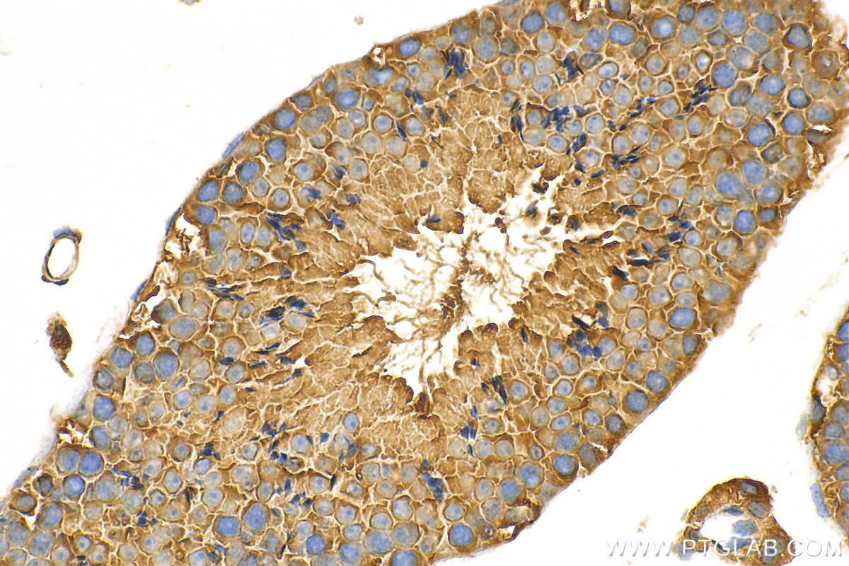 Immunohistochemistry (IHC) staining of mouse testis tissue using NEK4 Polyclonal antibody (31389-1-AP)