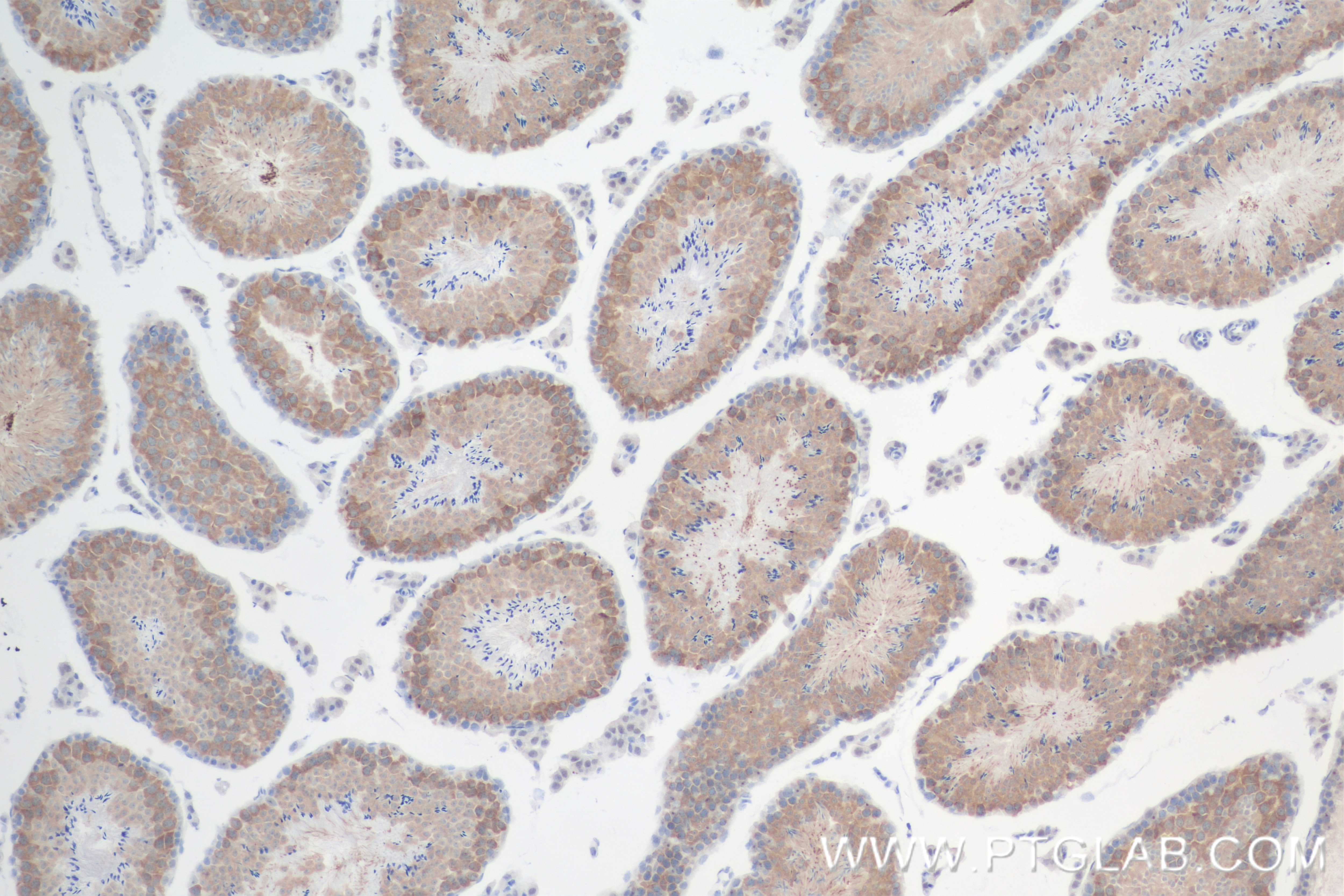 Immunohistochemistry (IHC) staining of mouse testis tissue using NEK4 Recombinant antibody (84654-4-RR)