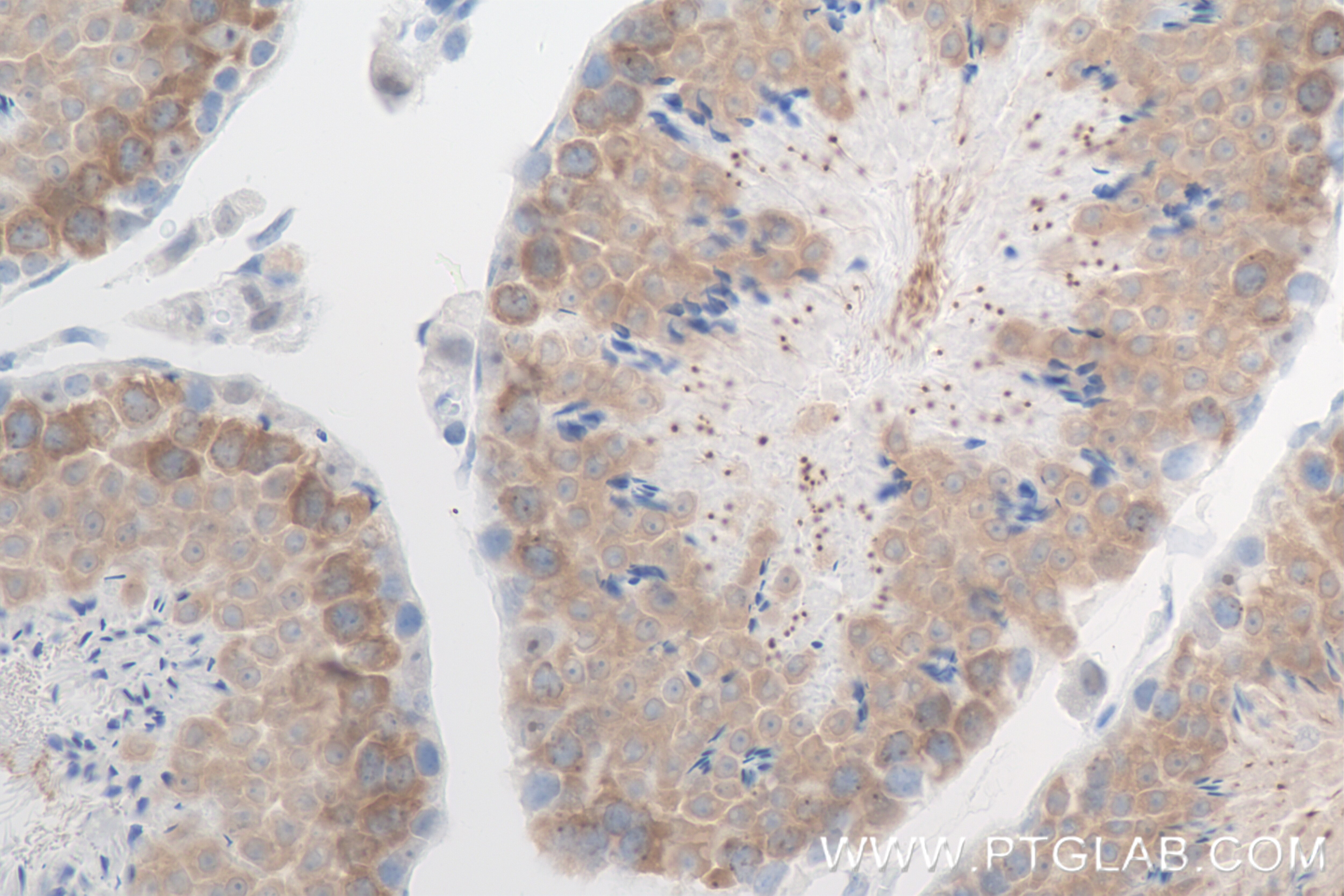 Immunohistochemistry (IHC) staining of mouse testis tissue using NEK4 Recombinant antibody (84654-4-RR)