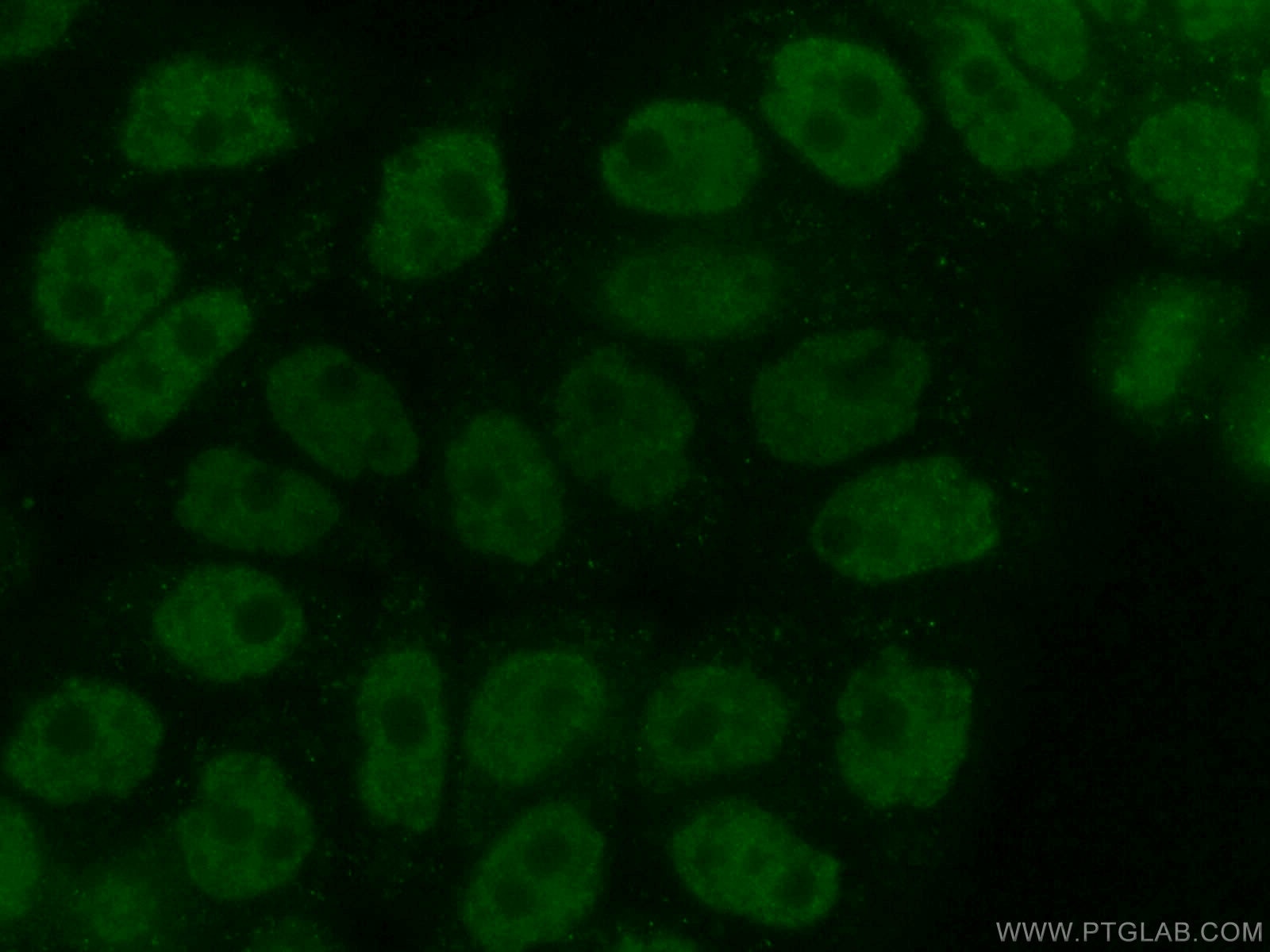 Immunofluorescence (IF) / fluorescent staining of HeLa cells using NEK6 Polyclonal antibody (10378-1-AP)