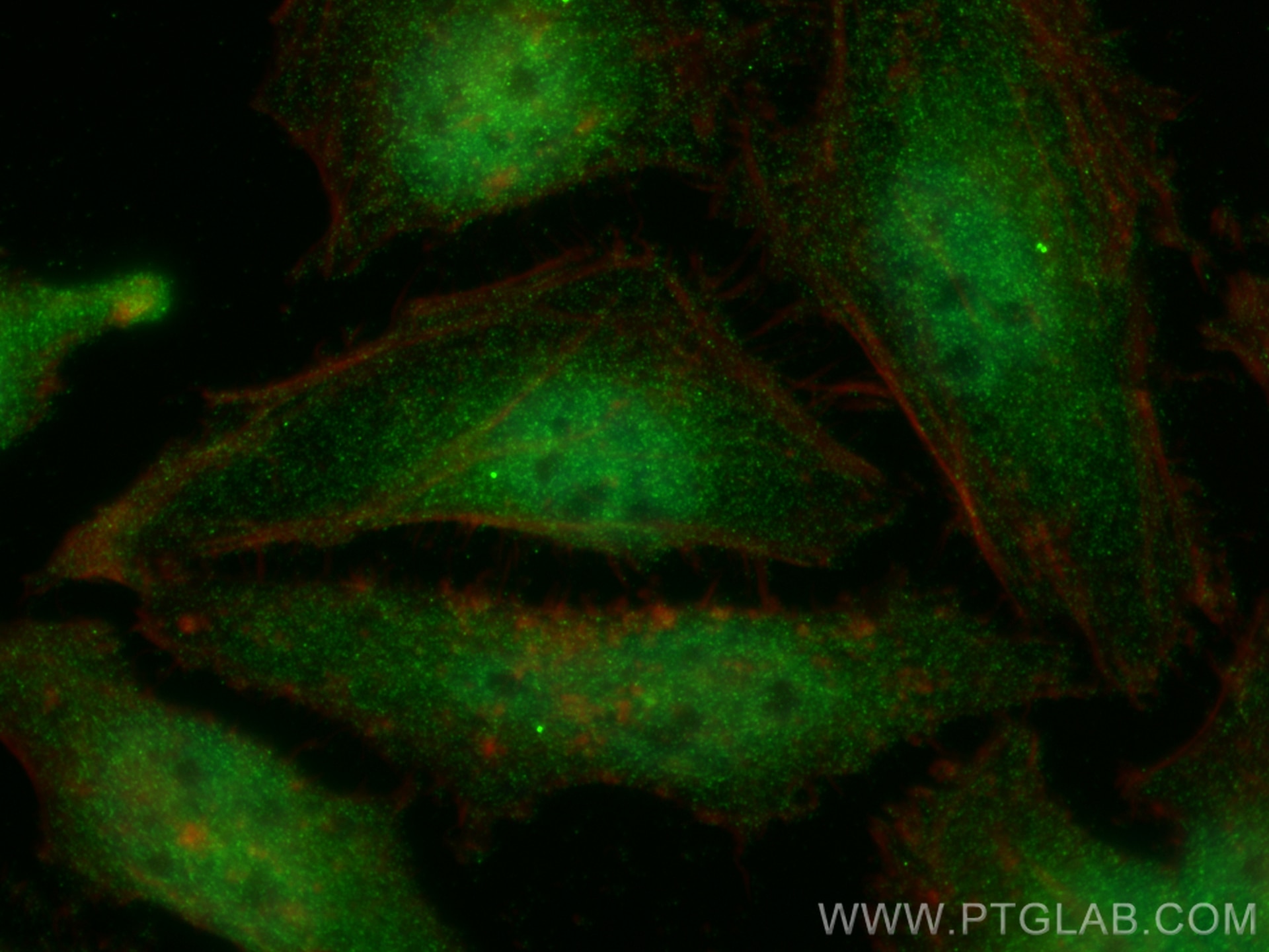 Immunofluorescence (IF) / fluorescent staining of HeLa cells using NEK6 Polyclonal antibody (10378-1-AP)