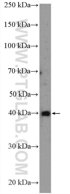 Western Blot (WB) analysis of HeLa cells using NEK6 Polyclonal antibody (10378-1-AP)