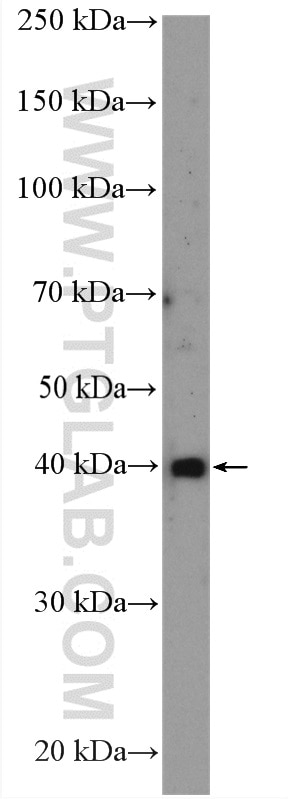 Western Blot (WB) analysis of HeLa cells using NEK6 Polyclonal antibody (10378-1-AP)