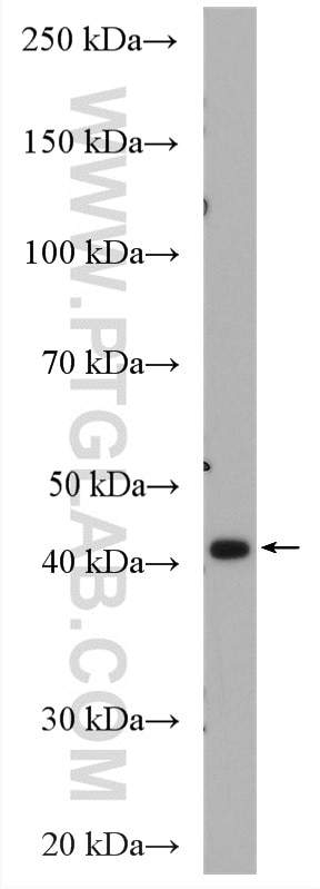 Western Blot (WB) analysis of HEK-293 cells using NEK6 Polyclonal antibody (10378-1-AP)