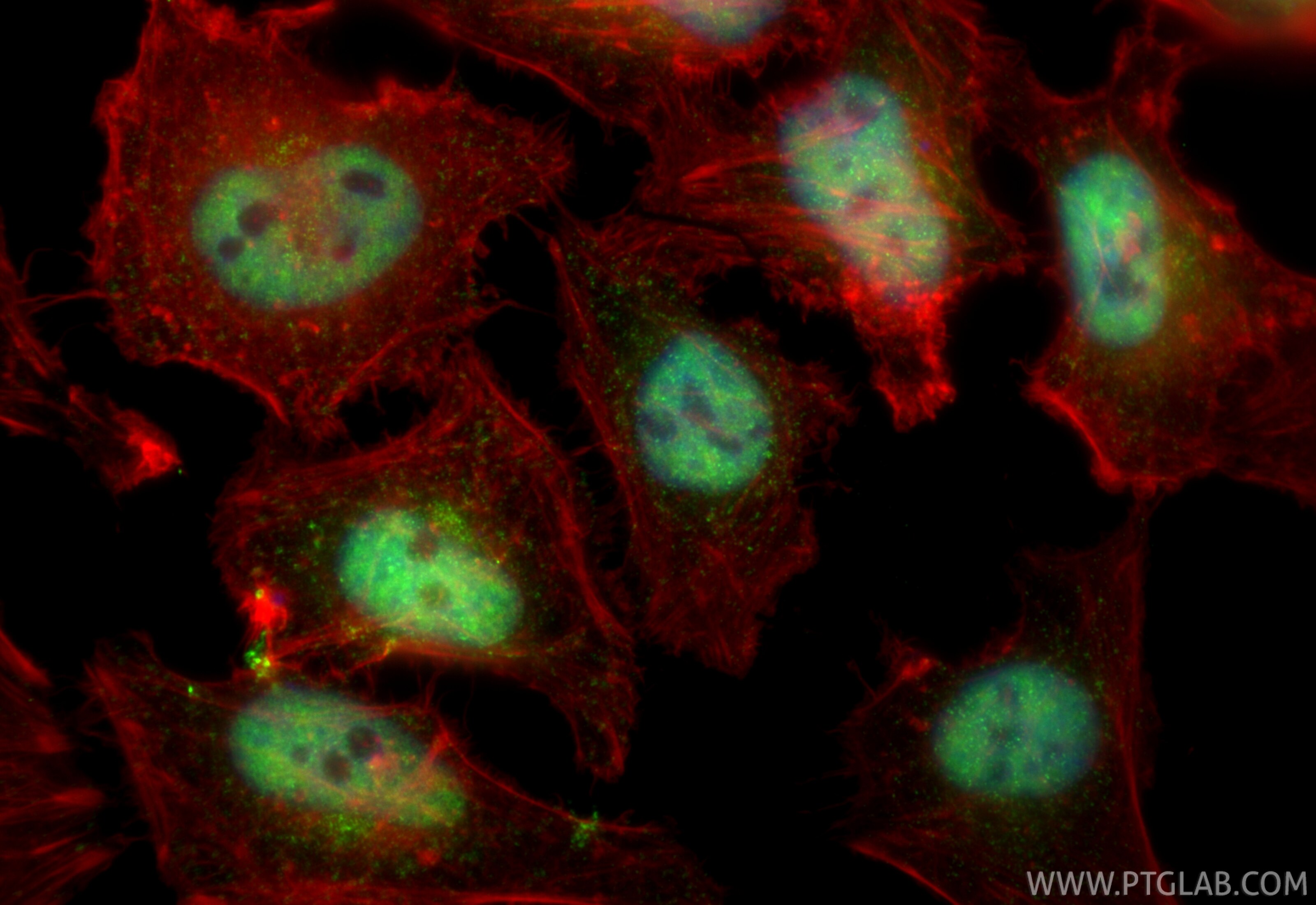 Immunofluorescence (IF) / fluorescent staining of HeLa cells using NEK6 Polyclonal antibody (28070-1-AP)