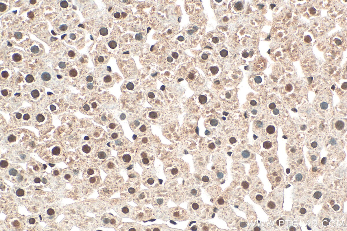 Immunohistochemistry (IHC) staining of rat liver tissue using NEK6 Polyclonal antibody (28070-1-AP)