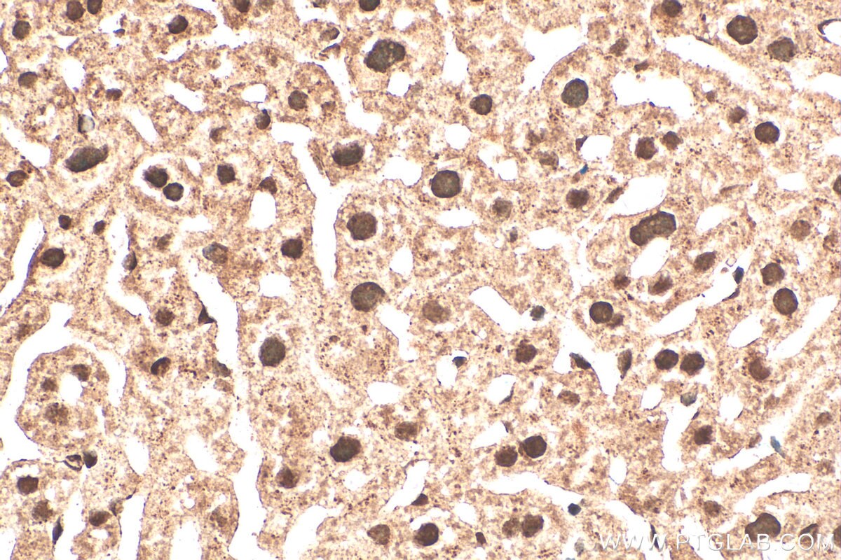Immunohistochemistry (IHC) staining of mouse liver tissue using NEK6 Polyclonal antibody (28070-1-AP)