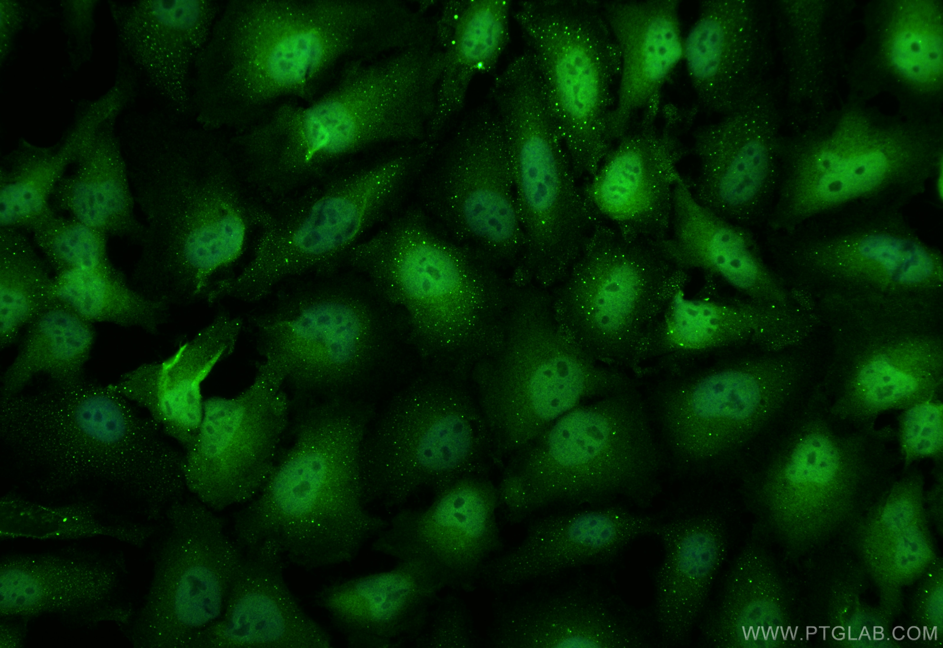 Immunofluorescence (IF) / fluorescent staining of HeLa cells using NEK7 Polyclonal antibody (31422-1-AP)