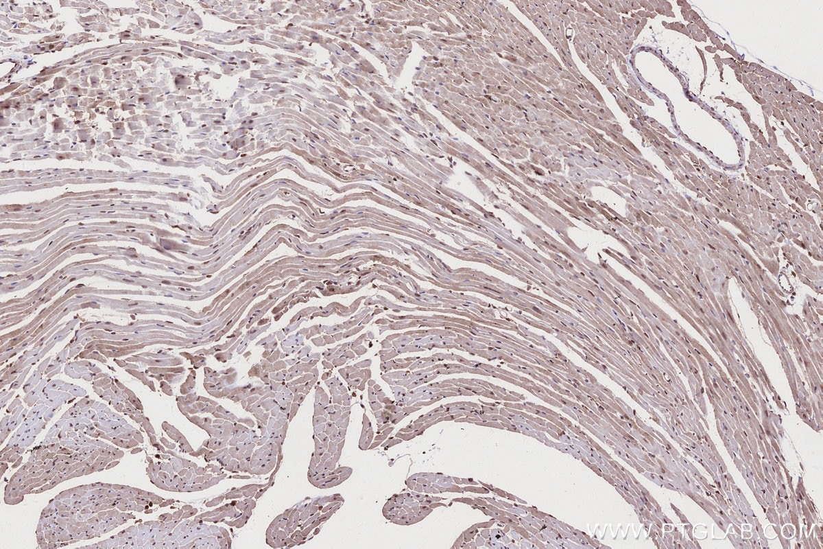 Immunohistochemistry (IHC) staining of mouse heart tissue using NEK7 Polyclonal antibody (31422-1-AP)