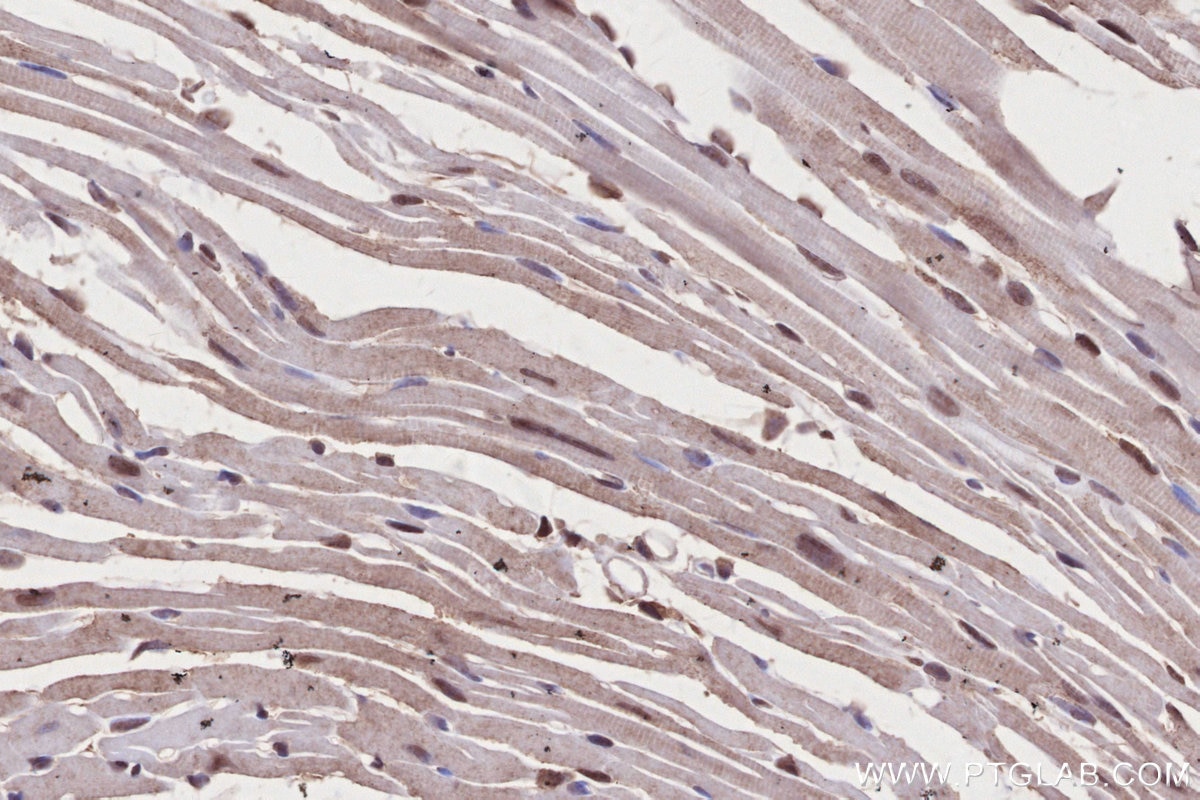 Immunohistochemistry (IHC) staining of mouse heart tissue using NEK7 Polyclonal antibody (31422-1-AP)
